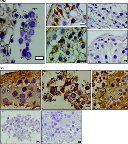 Figure 3.  Immunohystochemical detection of the CFTR protein in different pathologies of infertile patients. Severe oligozoospermia (SOZ): A-C) reaction, D,E) negative control. Retrograde ejaculation (RE): F-H) reaction, I,J) negative control. Sertoli cells (SC), spermatogonia A dark (Ad), spermatogonia A pale (Ap), primary spermatocytes at the leptotene stage (L), primary spermatocytes at the zygotene stage (Z), primary spermatocytes at the pachitene stage (P), telophase I (T1), secondary spermatocytes (ST2), round spermatids (Sa), early elongating spermatids (Sb), late elongating spermatids (Sc), elongated spermatids (Sd), spermatozoa (Sz). Bars: 10 µm (A-C), 5 µm (D-J).