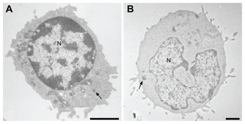 Figure 1 Electron micrographics of natural killer (A) and NK-92 (B) cells showing large lymphocyte-containing granules (arrows).