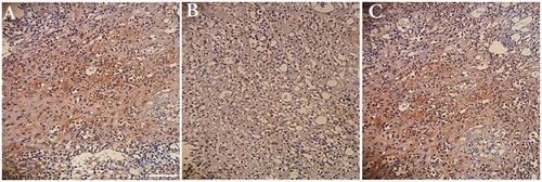 Figure 9. Immunohistochemistry with anti-NF antibody (Dark) for renovated nerves taken from autograft (A), conduit (B), conduit + NGF (C) groups at 12-weeks post implantation. Scale bar, 20 µm.