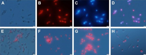 Figure 7 Fluorescent images of LLC cells after co-incubation with 10 μg/mL of oMCN@DOX@PEG at 37°C for 1 h.Notes: (A) Bright-field image, (B) DOX, (C) nuclei, and (D) merging images. (E–G) Fluorescent images of LLC cells incubated with oMCN@DOX@PEG with the equivalent DOX concentration (~5 μg/mL calculated by the drug-loading efficiency) taken at 0.5 h, 1 h and 2 h, respectively. (H) Fluorescent images of LLC cells incubated with 5 μg/mL of DOX for 1 h; the fluorescence is much weaker than that of F. The scale bar is 50 μm.Abbreviations: LLC, Lewis lung carcinoma; oMCN@DOX@PEG, polyethylene glycol-modified doxorubicin-loaded oxidized mesoporous carbon nanospheres; h, hours; DOX, doxorubicin.