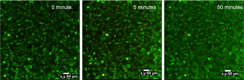 Figure S3 Confocal images of MCF-7 cells incubated with 100 mg mL−1 UCN-Ce6 for up to 50 minutes of NIR irradiation, to determine the exposure area of NIR irradiation.Abbreviations: Ce6, chlorin e6; NIR, near-infrared; UCN, upconversion nanoparticle.