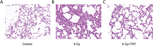 Figure 1 H&E staining of lung tissue at 72 h after radiation. Compared with the control group (A), the radiation-induced lung injury (6 Gy) group (B) showed thickened alveolar walls, alveolar septal edema, and massive inflammatory cell infiltration in the alveoli. The troxerutin pretreatment group (6 Gy+TRT) (C) could reduced the damage caused by radiation, maintained the normal morphology of lung tissue in mice.