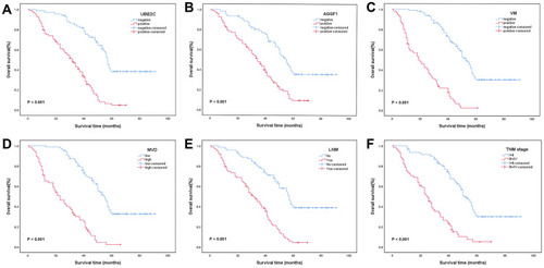 Figure 2 Kaplan-Meier analysis of OS in NSCLC patients. (A) Correlation between OS and UBE2C (χ2 = 49.521, P < 0.001). (B) Correlation between OS and AGGF1 (χ2 = 23.383, P < 0.001). (C) Correlation between OS and VM (χ2 = 86.409, P < 0.001). (D) Correlation between OS and MVD (χ2 = 73.650, P < 0.001). (E) Correlation between OS and LNM (χ2 = 43.688, P < 0.001). (F) Correlation between OS and TNM stage (χ2 = 53.170, P < 0.001).