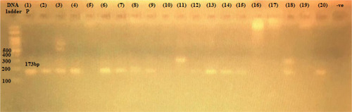 Figure 1 The 173-bp PCR amplification of rmtB gene among P. aeruginosa isolates. First lane, DNA ladder, 100-bp DNA size marker; (1) P, positive control, from 2 to 20 clinical isolates; −ve, negative control.