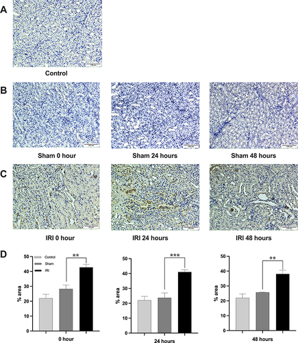 Figure 2 The expression of PD-L1 in kidney tissue of mice. The IHC of PD-L1 was shown in control groups (A), sham groups (B) and IRI groups (C). Quantification is represented in panel (D). Data are expressed as mean ± standard deviation. Difference between IRI group and sham group was made using unpaired Student’s t-test for normally distributed data. Images, × 200; original scale bar, 100 μm. **p<0.01. ***p<0.001. Images, × 200; original scale bar, 100 μm.