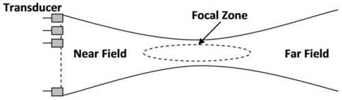 Figure 3. Linear-array ultrasound beam pattern.