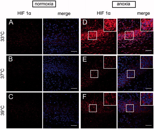 Figure 2. HIF-1α immunolocalization in the hippocampus of neonatal rats at different body temperatures (33 , 37 and 39 °C) 2 h after exposure to normoxic (A–C) or anoxic (D–F) conditions. Confocal images show HIF-1α detection (red). Co-staining for HIF-1α with Hoechst (merge) demonstrates anoxia-induced accumulation of HIF-1α in the hippocampal region. Scale bars – 50 µm.