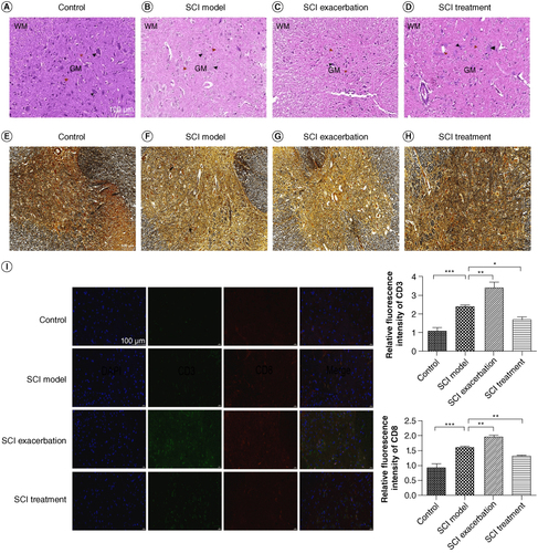 Figure 3. Successful establishment of SCI model via anti-PD-1 therapy. The pathological changes among the BMT Rag1−/− mice in the control (A), SCI model (B), SCI exacerbation (C) and SCI treatment (D) groups were observed via HE staining. WM represents white matter, GM represents gray matter, black arrow points to neurons and red arrow points to nerve fibers. Scale bar = 100 μm. Silver staining was conducted to further observe the structure of spinal cord in the control (E), SCI model (F), SCI exacerbation (G) and SCI treatment (H) groups. Scale bar = 100 μm. (I) Relative fluorescence intensity of CD3 or CD8 was calculated via immunofluorescence. Scale bar = 100 μm.*p < 0.05; **p < 0.01; ***p < 0.001.BMT: Bone marrow transplant; HE: Hematoxylin and eosin; PD-1: Programmed death 1; Rag: Recombination activating gene; SCI: Spinal cord injury.