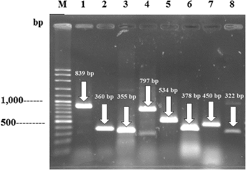 Figure 2. The PCR products of the detected virulence genes.Figura 2. Productos de la PCR de los genes de virulencia detectados
