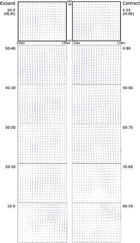 Figure 3. Vectors in the DVFs resulting from DIRs between PI and PE phases and the stepwise expansion and contraction corresponding to the PE→PI registration and the PI→PE registration respectively in a thoracic 4D-CT scan of a patient in SBF fixation without abdominal compression. Numbers indicate the phase of the breathing cycle as percent completed. The first number indicates the source image and the second number indicates the target image. The selected section of the DVF corresponds to a zoomed-in area around the particular patient's tumour in the transversal plane at a fixed longitudinal position. Horizontal axis shows lateral pixel value, vertical axis shows vertical pixel value. Note that the 512 × 512 pixels CT images are scaled to 256 × 256 pixels by the TPS when performing the DIR. The vector sizes and directions of the smaller-step deformations verify that stepwise expansion corresponds to the predicted total expansion of the PE→PI registration and similarly for the contraction of the PI→PE registration.