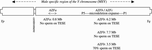 Figure 1.  Clinically significant microdeletion intervals along the long arm of the Y chromosome (Tq).