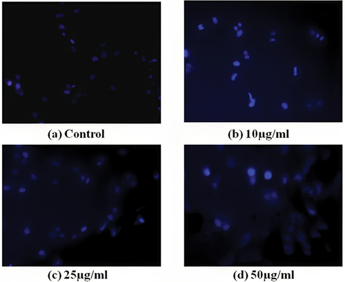 Figure 11. DAPI staining of aqueous extract of Pedalium murex L. copper nanoparticles against A549 cancer cell in control (a), 10µg/ml (b), 25µg/ml (c), and 50µg/ml (d).