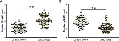 Figure 1 The expression of SNHG10 and miR-621 was significantly altered in AML. The expression of SNHG10 (A) and miR-621 (B) in BMMNCs from both AML patients (n = 60) and healthy controls (n = 60) was determined by RT-qPCR. The expression levels of SNHG10 and miR-621 in BMMNCs were expressed as average values of three technical replicates. **p < 0.01.