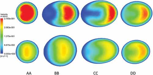 Figure 8. Velocity profiles on the slice planes AA, BB, CC, DD at peak diastole: stenosed model in top row and stented model in bottom row.