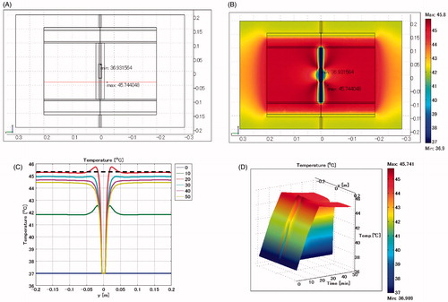 Figure 6. Biliary duct stent placed in vertical direction. Lumen: vessel. (A) Cross-sectional view of the model at x = 0 cm. (B) Temperature distribution after heating for 20 min. (C) Temperature profiles on the red line shown in Figure 6A. (D) Extrusion plot of temperature distribution on the red line shown in Figure 6A. Maximum SAR 2027 W/kg; maximum temperature 45.7 °C.