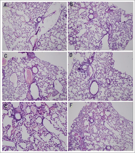 Figure 1. Pathological changes detected by HE staining. (A) Uninfected mice in a normal environment. (B) Infected mice in a normal environment. (C) Uninfected mice in the wet environment. (D) Infected mice in the wet environment. (E) Uninfected mice in the warm-wet environment. (F) Infected mice in the warm-wet environment.