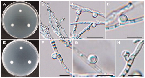 Figure 12. Morphology of Tetracladium globosum CNUFC CPWS-1. (A,E) Colonies on potato dextrose agar. (A) obverse view, (E) reverse view. (B–D) Conidia and hyphae. (F–H) Conidia. Scale bars: B-C = 20 µm, D, F-H = 10 µm.