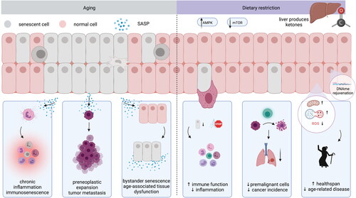 Figure 1. Schematic overview of involvement of senescent cells in aging and how DR may aid disease prevention or treatment and increase healthspan. Abbreviations: SASP, senescence-associated secretory phenotype; DNAme: DNA methylation; ROS: reactive oxygen species.