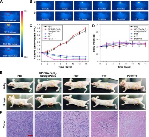 Figure 8 Therapeutic effects of GP-PGA-Fe3O4-CDs@BPQDs in mice exposed to NIR after injection.Notes: (A) Highest temperature within the tumor area recorded by an IR camera after 660 or 808 nm laser irradiation. (B) Thermography of tumor-bearing mice receiving photothermal treatment for different periods: a, 808 nm, 2.0 W/cm2, 5 min; b, 660 nm, 0.5 W/cm2, 10 min. (C) Weight-growth curves. Mice were measured every 2 days. (D) Tumor growth curves (n=5). Measurements taken after different treatments. (E) Mice with HeLa tumors after various treatments. (F) H&E staining of tumor sections collected from different treatment groups. Scale bar =50 μm.Abbreviations: GP, genipin; PGA, polyglutamic acid; CDs, carbon dots; BPQDs, black phosphorus quantum dots; NIR, near-infrared; PTT, photothermal therapy; PDT, photodynamic therapy.