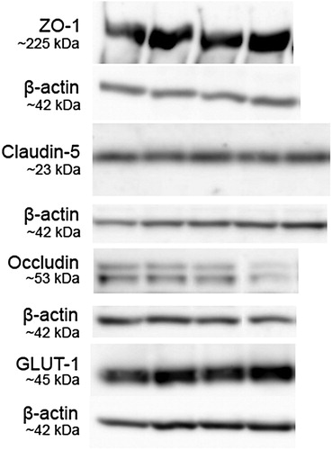 Figure 2 Representative western blots on hypothalamic tissue lysates of two fcHFHS diet-fed (left bands) and two chow-fed animals (right bands) for ZO-1, occludin, and GLUT-1 protein, with β-actin protein as control for amount of protein loaded. Claudin-5 bands are shown of lysates of two fcHFHS diet animals on the left and right, and three chow-fed animals in the middle. Molecular weight is depicted next to blots.