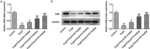 Figure 7. Chrysin molecule targeted ERβ and activated ERβ expression in premature ovarian failure. The mRNA (a) and protein (b) levels of ERβ were detected using RT-qPCR and western blot, respectively.