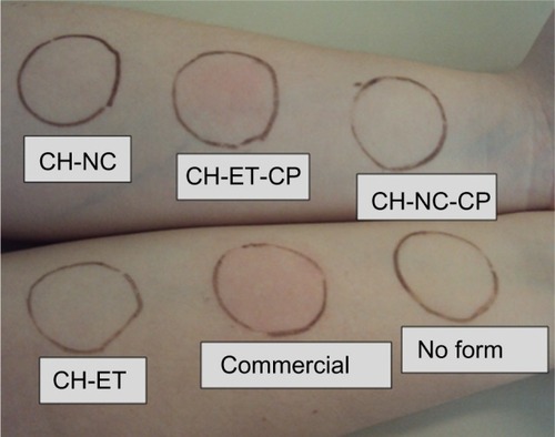 Figure 5 Arm of a volunteer 90 minutes after application of the formulations. The photograph is representative of the entire experiment.Abbreviations: CH, chitosan gel; NC, nanocapsules; CP, capsaicinoids; ET, ethanolic solution; Commercial, commercial formulation.