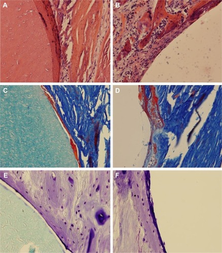 Figure 6 The HE, Masson, and toluidine blue staining.Notes: (A, C, E) in the experimental group and (B, D, F) control group at 4 weeks postoperative (×200).Abbreviation: HE, hematoxylin and eosin.