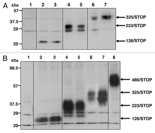 Figure 1. Protein expression levels of CaOV-3 and CHO-Ras stable transformants. CaOV-3 cells were stably transfected with an empty vector, 126/STOP, 223/STOP or 325/STOP, and expression levels of representative clones were shown by western blot. (A) Lane 1, empty vector, Lane 2, 126/STOP #12; Lane 3, 126/STOP #16; Lane 4, 223/STOP #8; Lane 5, 223/STOP #13; Lane 6, 325/STOP #21; Lane 7, 325/STOP #22. CHO-Ras cells were stably transfected with the same plasmids to get high protein expression levels. Conditioned media from representative CHO-Ras stable transformants were separated and stained with anti-IGF-IR α-subunit. (B) Lane 1, empty vector, Lane 2, 126/STOP #14; Lane 3, 126/STOP #16; Lane 4, 223/STOP #23; Lane 5, 223/STOP #26; Lane 6, 325/STOP #12; Lane 7, 325/STOP #15; Lane 8, 486/STOP #13.