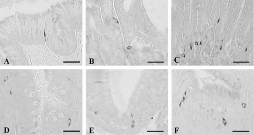 Figure 1. Cells stained for Cg A in the alimentary tract of the Korean golden frog. Open-typed cells were dispersed in the epithelium or mucosal glands of the esophagus (A), antrum (B), pylorus (C), duodenum (D), ileum (E), and rectum (F) with rare close-typed cells, occasionally. Scale bars = 80 µm; PAP method.