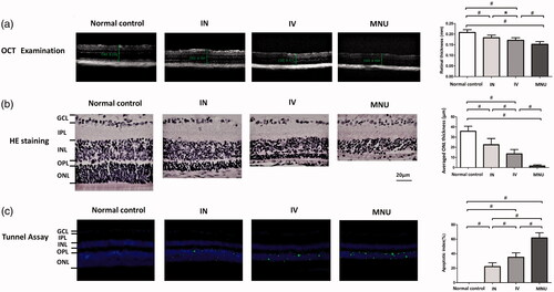 Figure 3. (A) The OCT examination found that the ONL architecture in the MNU group was terribly disrupted. However, these mice in the IVen and INas administered group had relatively intact retinal architecture. The retinal thickness in the MNU group was significantly smaller than that in the IVen administered group. The retinal thickness in the IVen administered group was significantly smaller than that in the INas administered group. (B) The mean ONL thickness in the IVen administered group was significantly smaller than that in the INas administered group. (C) TUNEL-positive cells in the INas administered group was significantly less compared with the MNU group. The apoptotic index (AI) of the MNU group was significantly larger than that of the IVen administered group. The AI of the INas group was significantly smaller compared with the IVen administered group (GCL, Ganglion cell layer; IPL, inner plexiform layer; OPL, outer plexiform layer; ONL, outer nuclear layer; INL, inner nuclear layer; ANOVA analysis followed by Bonferroni's post-hoc analysis was performed,*p < .05, #p < .01, for differences between groups; n = 10).