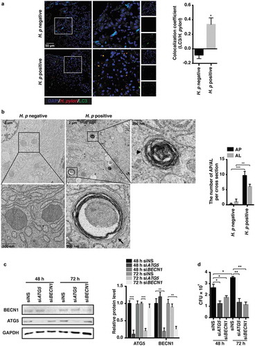 Figure 4. Autophagosomes were taken by H. pylori as survival niches in human stomachs. (a) H. pylori-negative (n = 7) and -positive (n = 12) human patient biopsies were stained to visualize LC3B (green), H. pylori (red) and nuclei (blue). Thirty visual fields per group were randomly selected. Colocalization coefficient was presented as the percentage of punctate signals of LC3B that were positive for H. pylori. Scale bar: 50 µm. Reported values are the means ± S.E.M. *p < 0.05. (b) Ultrastructural features of H. pylori-negative (n = 5) and -positive (n = 12) human patient biopsies were analyzed by transmission electron microscopy. Scale bar: 2 µm. (Left panel) The typical images of mitochondria, autophagosomes (AP, arrow) enclosing intact H. pylori and autolysosomes (AL, arrowhead) are shown at higher magnification. (Right panel) Fifteen consecutive cross-sections from each patient were selected to count the number of autophagosomes and autolysosomes. (c–d) HFE145 cells transfected with control, ATG5- or BECN1-specific siRNAs were infected with the H. pylori SS1 strain (MOI 100) for the indicated times. (c) Cell lysates were analyzed and quantified for ATG5 and BECN1 protein levels. (d) Cells were permeabilized with 0.5% saponin for 15 min at room temperature, then plated on blood agar plates with serial dilutions, and cultured for 1 week to count colony number. The quantitative data are presented as means ± S.E.M. *P < 0.05; **P < 0.01; ***P < 0.001.