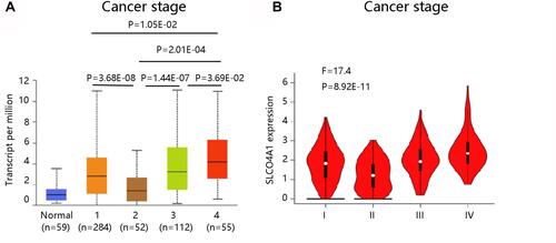 Figure 3 SLCO4A1 expression at different stages in thyroid cancer. (A) UALCAN. (B) GEPIA.