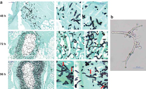 Figure 6. (a) Histopathology of G. mellonella larvae infected with 106 phialidic conidia of A. hortai 142. Larvae were infected, incubated at 37°C and sacrificed at the indicated time points. To simplify recognition of fungal elements samples were stained with Grocott´s silver stain. (b) Presence of AC on A. hortai 142 hyphae grown at 37°C in liquid Sabouraud medium for 5 days.