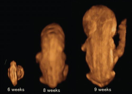 Figure 5.  3D reconstructed image of the embryo (6–9 weeks of gestation). Embryonal sizes are 5.5 mm, 18.3 mm and 26.3 mm. At 9 weeks of gestation, the spinal cord is demonstrated as a thin line, compared with that at 8 weeks of gestation.