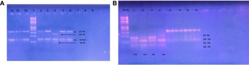 Figure 2 (A) C677T exon. 1c, 2c, 3c control undigested PCR products. 1, 50bp ladder, 2,3,5, 6 MTHFR (677CC), 4, MTHFR (677TT). (B) MTHFR A1298C exon. 50 pb, 1,3 MTHFR (1298AC), 2, 4 MTHFR (1298AA), 1c.2c.3c control undigested PCR products.