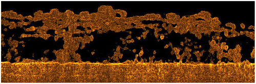Fig. 1. OCT 2-D image of a grown biofilm on a membrane surface without feed spacer in an area of a 3.83 mm × 0.85 mm. The membrane is shown at the bottom of the figure. The biofilm had a heterogeneous structure containing voids.