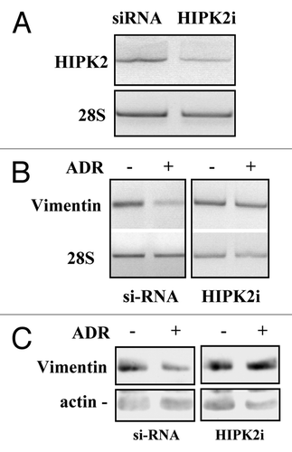 Figure 3. HIPK2 knock-down impairs the ADR-induced vimentin downregulation. (A) MDA-MB-231 cells were transfected with the control (siRNA) or specific HIPK2 interfering vector (HIPK2i) and 36 h after transfection mRNA was extracted for semi-quantitative RT-PCR analysis of HIPK2 levels. 28S mRNA levels were detected as control of cDNA inputs. (B) MDA-MB-231 control or HIPK2-interfered cells as in (A) were treated with ADR (1.5 μg/ml) and for 12 h after treatment mRNA was extracted for semi-quantitative RT-PCR analysis of vimentin levels. 28S mRNA levels were detected as control of cDNA inputs. (C) MDA-MB-231 control or HIPK2-interfered cells were treated as in (B) equal amount of total cell extracts were analyzed by protein gel immunoblotting with anti-vimentin antibody. Hsp70 detection was used as protein loading control.