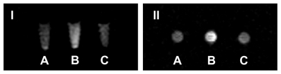 Figure 6 T1-weighted image of KB cells after incubated with contrast agents (I, coronal scan; II, axial scan) (A) L-Gd/calcein. (B) F-L-Gd/calcein. (C) F-L-Gd/calcein + 1 mM FA.Abbreviation: FA, folic acid.