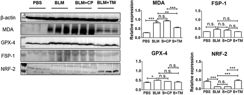 Figure 8. Tocilizumab mimotopes induced the significant changes on MDA and nrf-2 in the lung tissues tissue protein extraction was performed with tissue extraction reagent I. Lysates were separated by SDS-polyacrylamide gel electrophoresis and then transferred to PVDF membranes. The membranes were blocked with 5% bovine albumin and then treated with the primary and secondary antibodies. The membranes were scanned using a chemiluminescence/fluorescence image analysis system. The results showed that tocilizumab mimotope immunization could significantly induce the significant changes on MDA and nrf-2 in the lung tissues. (mean ± SEM; ***p < .001; **p < .005; *p < .05; n.s. non-significant; Representative image, n = 6 mice per group).