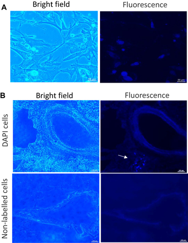 Figure 3 Detection of transplanted MSCs in the lung. (A) Representative image showing 4’,6-diamidino-2-phenylindole (DAPI)-labelled MSCs. (B) DAPI-labelled MSCs (2×106) (upper panel) were injected via the wing vein of broiler chickens. The unlabeled MSCs (lower panel) were served as a control. At d 6 post implantation, lung was collected and embedded in optimal cutting temperature (OCT) compound to obtain 15-μm-thick sections for determination of DAPI-positive cells (arrow). Images were acquired with fluorescence microscopy. Bright field and DAPI-fluorescence are shown.