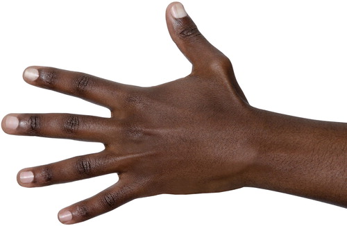 Figure 1. Hand.