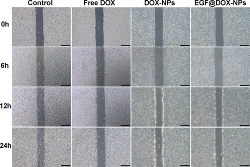 Figure 5. Typical images of wound healing of A549 monolayer after treatment with different drugs for 0, 6, 12, and 24 h (DOX concentration: 1 μg/mL; Scale bar: 500 μm).