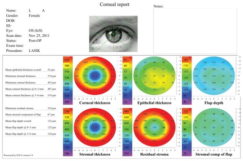 Figure 1 Standard corneal analysis report used in our investigation.