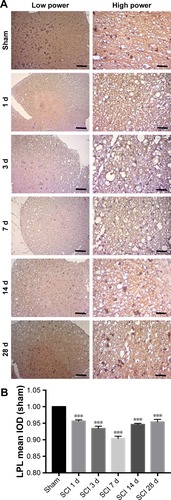 Figure 5 Immunohistochemistry of LPL in tissue from different time points after SCI and sham operation groups.
