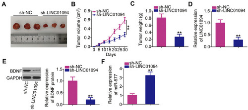 Figure 6 Depletion of long intergenic non-protein coding RNA 1094 (LINC01094) inhibits glioblastoma xenograft growth in vivo. (A) Tumor xenografts were excised on day 30 after cell injection and photographed. (B) Tumor volumes were monitored every 5 days after cell injection, as shown in the corresponding growth curves. (C) The weights of the xenograft tumors were measured 30 days after cell injection. (D–F) The expression levels of LINC01094, BDNF protein, and microRNA-577 in the xenograft tumors. **P < 0.01.