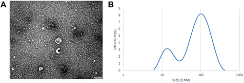 Figure 2 Identification of serum exosomes. (A) The morphology of serum-derived exosomes was observed by TEM. Scale bar= 100 nm. (B) Particle diameter detection of exosomes.
