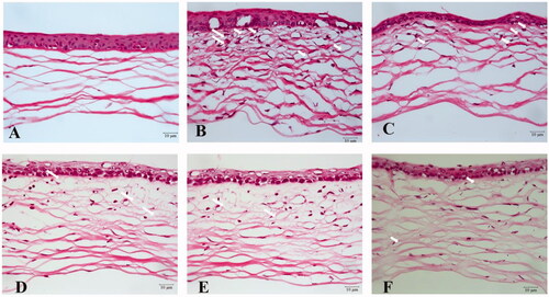 Figure 13. Histopathological examination of mice cornea. (a) Hematoxylin and eosin (HE) staining of corneal sections in the normal group (400×); (b) HE staining of corneal sections in the saline group (400 ×); (c) HE staining of corneal sections in the 0.0125% (L group) (400 ×); (d) HE staining of corneal sections in the 0.025% SRB-NLC group (M group) (400×); (e) HE staining of corneal sections in the 0.05% SRB-NLC group (H group) (400×); (f) HE staining of corneal sections in the glucocorticoid group (DEX group) (400×). The arrow indicates corneal neovascularization.