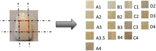 Figure 3 Region area from dental image partition for each type. A1–A4, B1–B4, C1–C4, D1–D4 (the VITAPAN classical family shade guide; Internationally established dental shade guide commercial product).