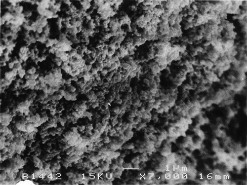 Figure 1 SEM micrograph of Streblus asper milk coagulum (7000×).