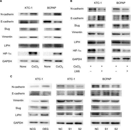 Figure 4 HIF-1α regulated the protein expression levels of LIPH, Slug, and E-cadherin, and the protein expression level of LIPH regulated Slug and E-cadherin.Notes: (A) The protein expression level of HIF-1α was obviously overexpressed in KTC-1 and BCPAP hypoxia models. The protein expression levels of LIPH, Slug, N-cadherin, and vimentin were significantly upregulated and E-cadherin was downregulated in KTC-1 and BCPAP hypoxia models in comparison with their negative control groups. (B) The protein expression levels of HIF-1α, LIPH, Slug, N-cadherin, vimentin, and E-cadherin showed the opposite trend in the inhibitor groups in comparison with the hypoxia groups. (C) The influence of LIPH expression on the well-known epithelial–mesenchymal transition pathway molecules Slug, N-cadherin, vimentin, and E-cadherin in KTC-1 and BCPAP was analyzed by Western blot assay. The expression levels of Slug, N-cadherin, and vimentin were positively regulated by LIPH expression, while E-cadherin was negatively regulated by LIPH expression.Abbreviations: CoCl2, cobalt(II) chloride; GAPDH, glyceraldehyde-3-phosphate dehydrogenase; HIF-1α, hypoxia inducible factor-1α; LIPH, lipase H; NC, negative control; NCG, negative control group; OEG, overexpression group; S1, S2, experimental groups.